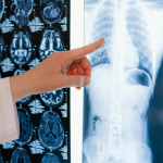 Radiologia no diagnóstico do câncer: conheça os principais exames de imagem e seu papel no acompanhamento oncológico com a Dra. Thaline Neves.