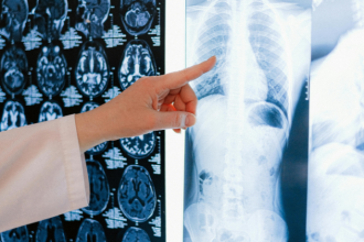 Radiologia no diagnóstico do câncer: conheça os principais exames de imagem e seu papel no acompanhamento oncológico com a Dra. Thaline Neves.