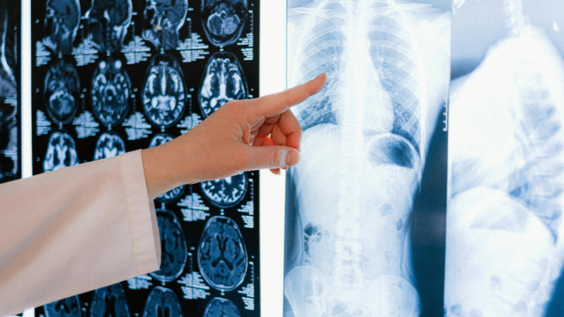 Radiologia no diagnóstico do câncer: conheça os principais exames de imagem e seu papel no acompanhamento oncológico com a Dra. Thaline Neves.